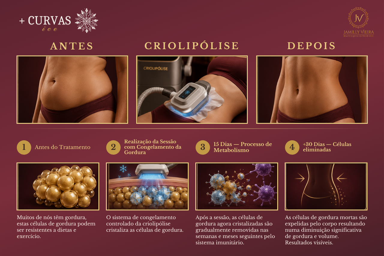 Antes, criolipólise e depois