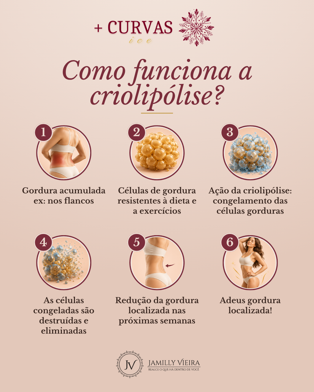 Como funciona a criolipólise, em 6 etapas
